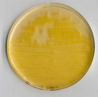PSEUDOMONAS AGAR F BASE FOR MICROBIOLOGY